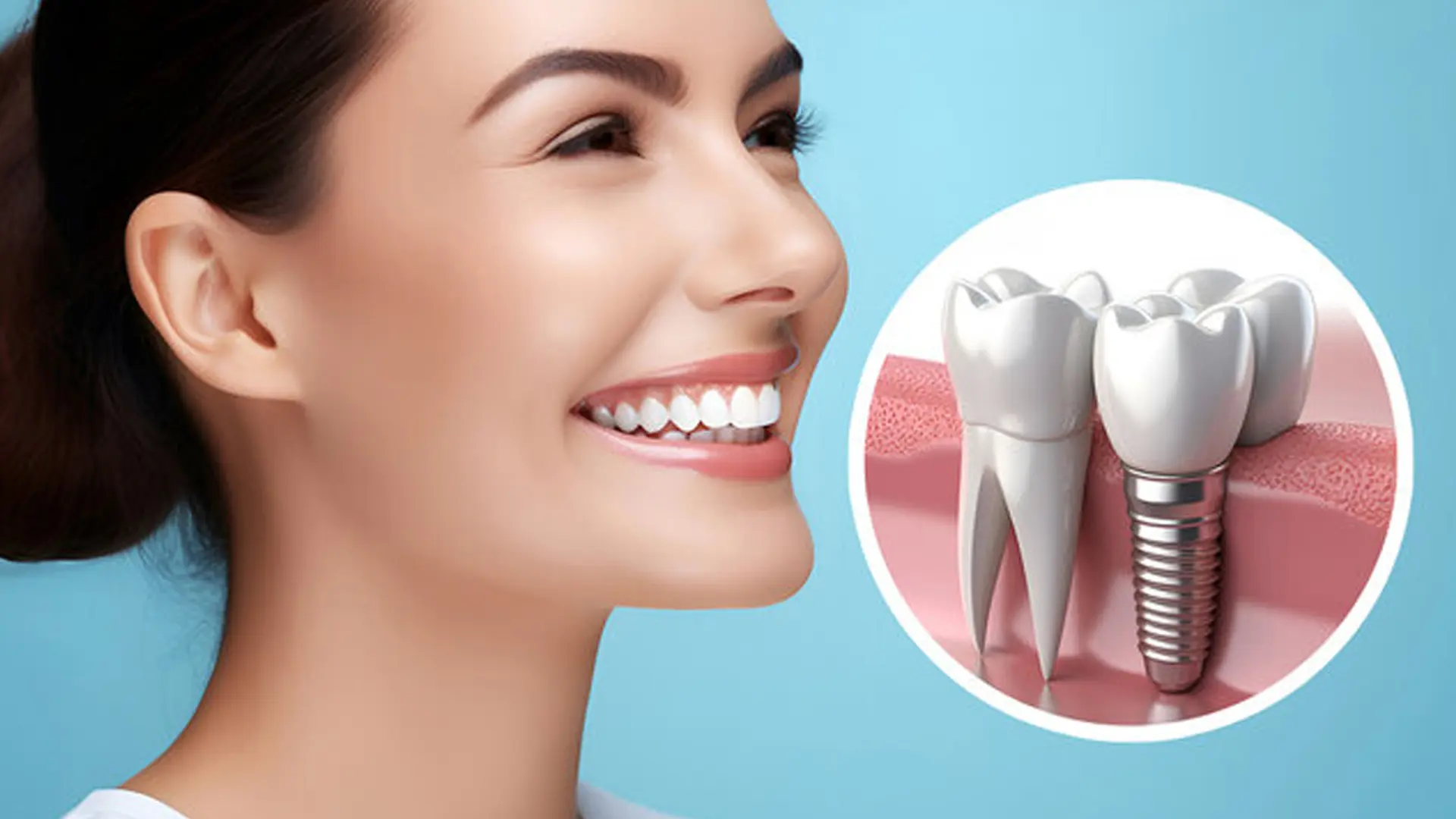 The Best Implant Options For Perfect Smile